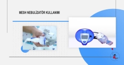 Mesh Nebulizatör Kullanımı